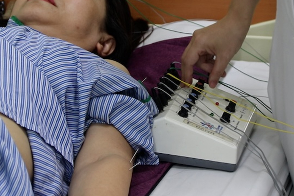 Châm Cứu Phục Hồi Chức Năng Sau Tai Biến Tại Nhà